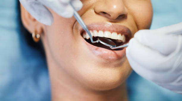 Best Emergency Tooth Extraction in Hillsdale, MI