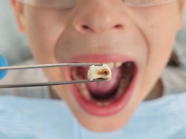Best Emergency Treatment for Toothache in Hillsdale, MI